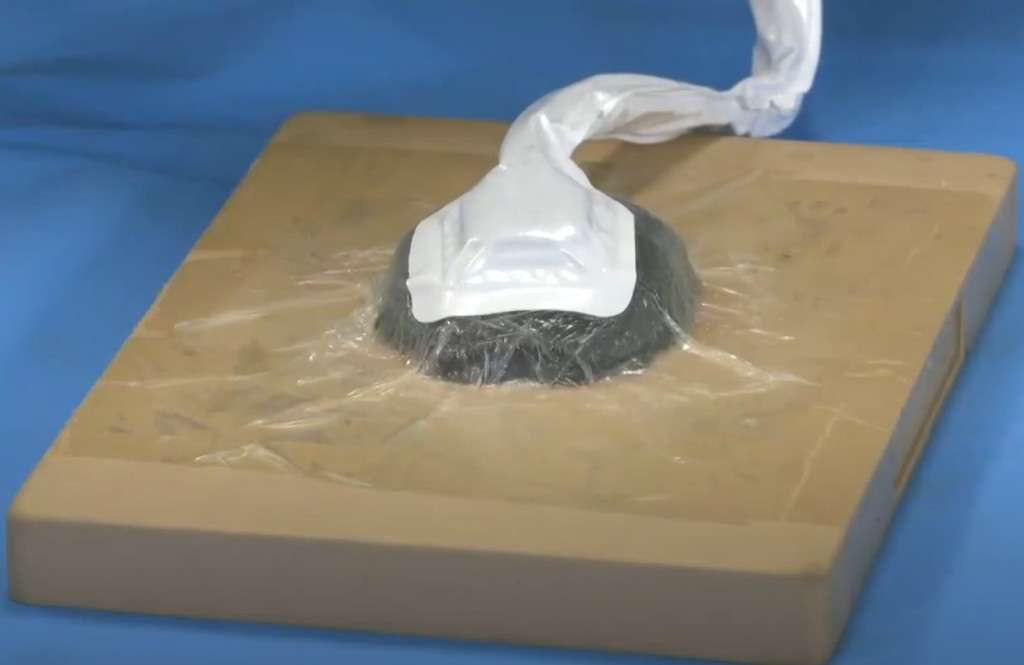 Tratamientos de heridas con terapia de presión negativa: Perspectiva de enfermería.